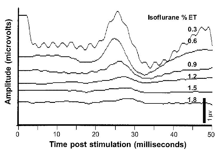 SSEP Baseline: When Do You Set Your Final Baselines?